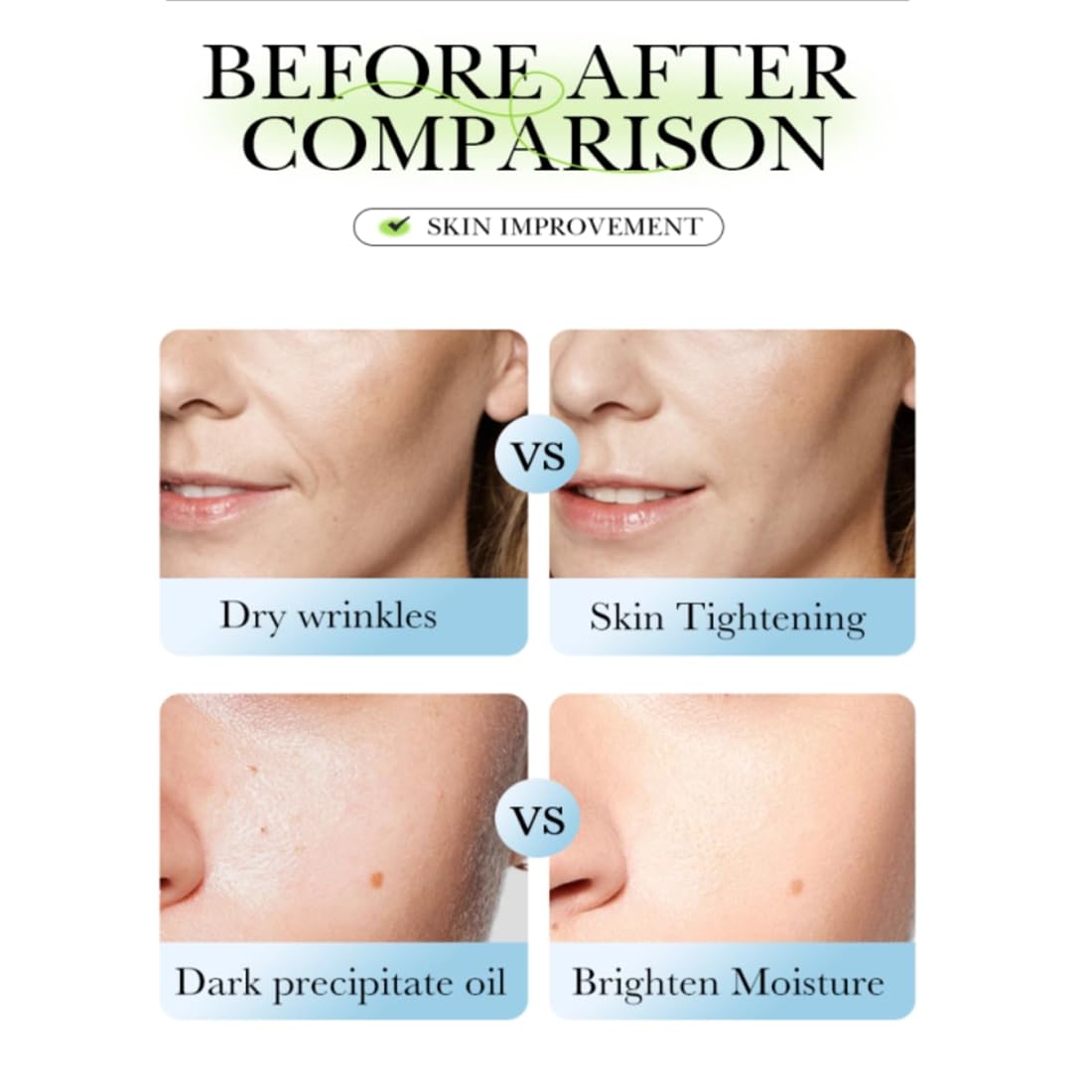 Specialized Moisturizing Cream for Fragile Skin: Restores & Rejuvenates Mature Skin - Daily Anti-Wrinkle Moisturizer for Firming & Strengthening Thin, Aging Skin - 4.5 Oz