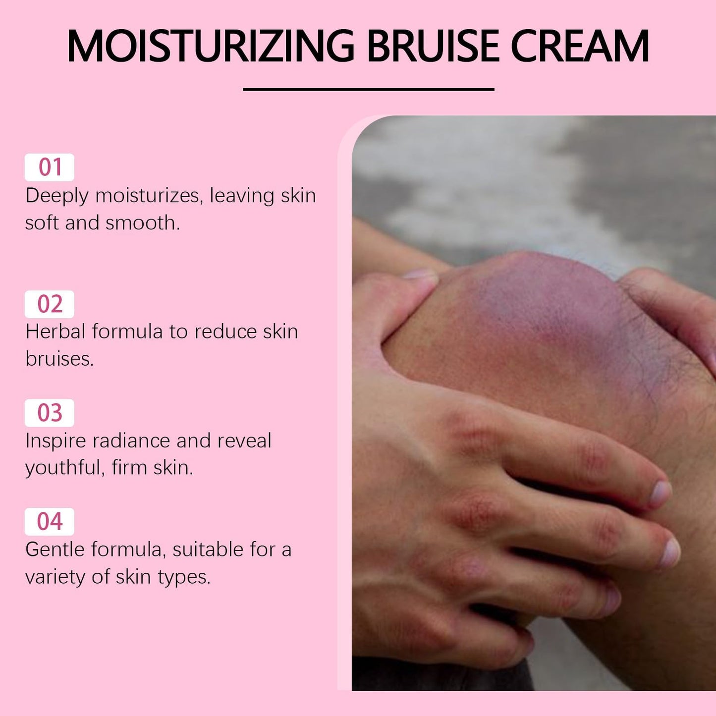 Bruise Cream - Moisturizer for Bruises on Arms, Legs & Hands - Restores Fragile Skin with Anti-Wrinkle Formula for Firming & Strengthening - 4.5 Oz